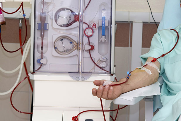 dialysis-peritoneal-dialysis-hemodialysis-all-about-kidney